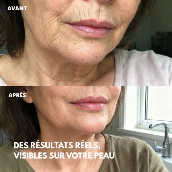 Stick Repulpant Bio-Collagène PDRN