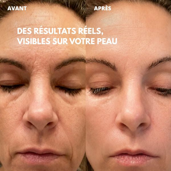 Stick Repulpant Bio-Collagène PDRN